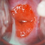 ������� ��������� � �����