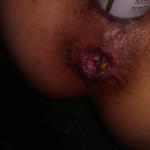 ��� �������