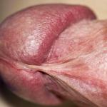 ���� �����